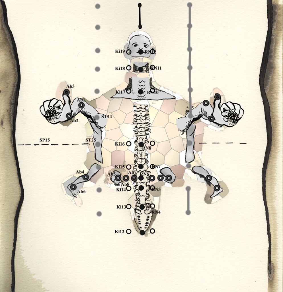 Abdominal Acupuncture A Case History Dantien Accupuncture