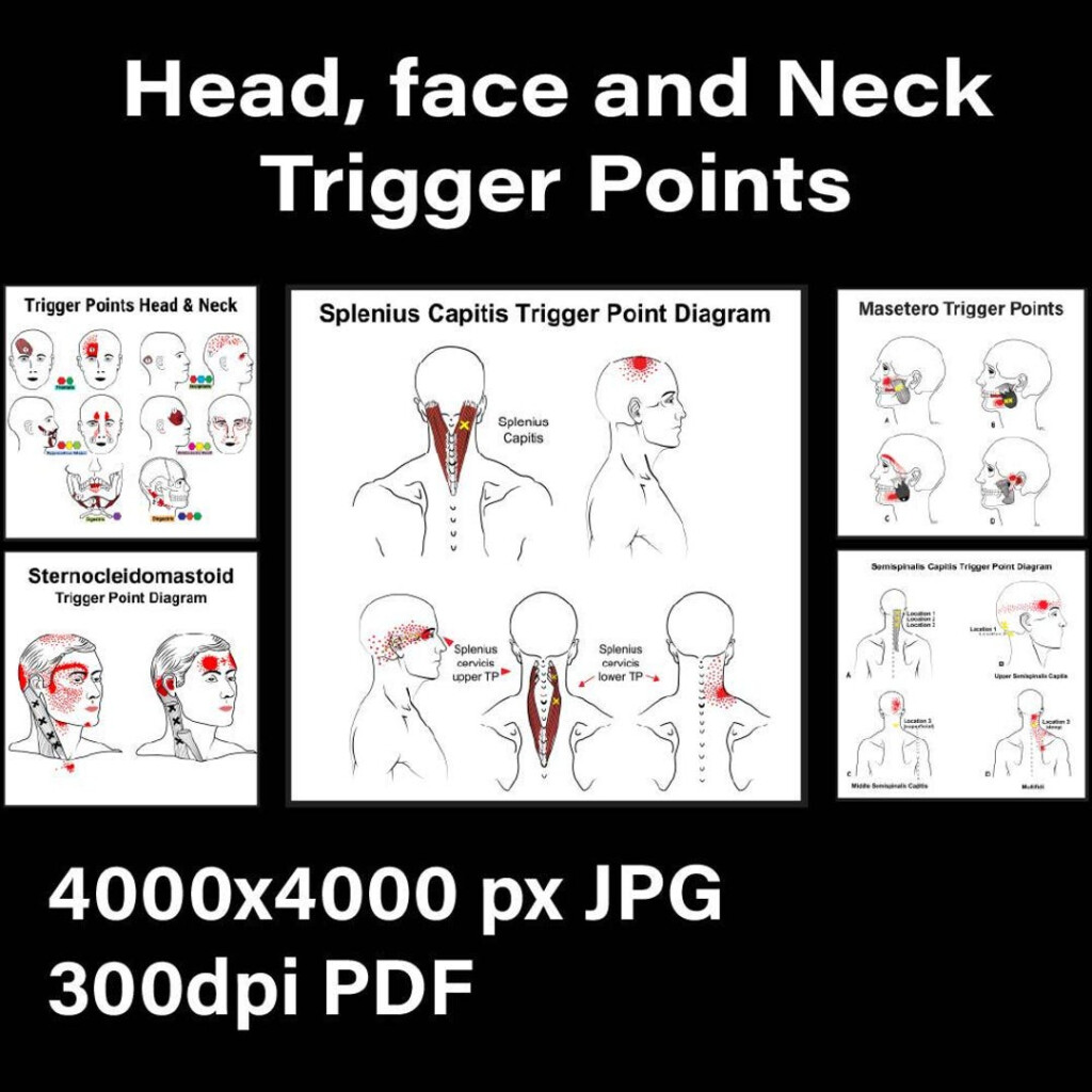 Head Neck Trigger Point Charts Muscle Pain Relief Diagrams PDF Etsy Israel Head Neck Trigger Point Charts Muscle Pain Relief Diagrams PDF Etsy Israel