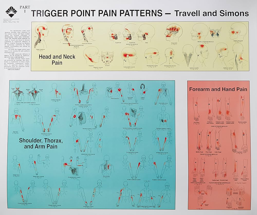 Trigger Points Of Pain Wall Charts Set Of 2 9780683083682 Medicine Health Science Books Amazon Trigger Points Of Pain Wall Charts Set Of 2 9780683083682 Medicine Health Science Books Amazon